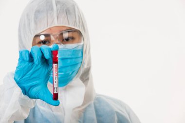 PPE üniformalı tıp bilimcileri, Coronavirus test tüpü taşıyan bir maske takıyor. Bir hastane laboratuvarında, beyaz, ilaç COVID-19 salgın konseptini analiz etmek için kullanılan bir kan örneği.
