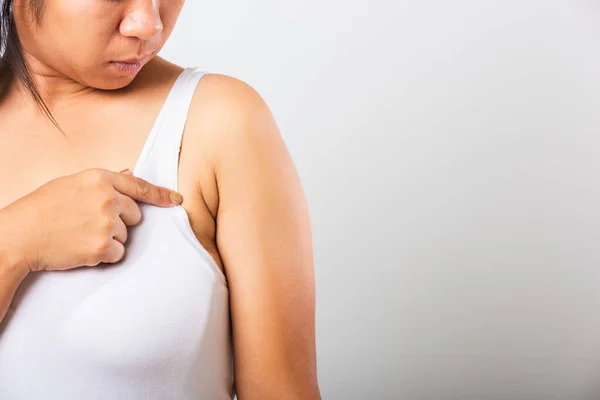 Närbild Asiatisk Kvinna Pekar Hennes Hud Underarm Hon Problem Armhåla — Stockfoto