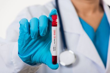 Beyaz üniformalı doktor Coronavirus test tüpü taşıyan bir maske takıyor. Klinik bir laboratuvarda, beyaz, ilaç COVID-19 salgın konseptini analiz etmek için kan örneği alınıyor.