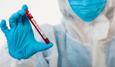 PPE üniformalı tıp bilimcileri, Coronavirus test tüpü taşıyan bir maske takıyor. Bir hastane laboratuvarında, beyaz, ilaç COVID-19 salgın konseptini analiz etmek için kullanılan bir kan örneği.