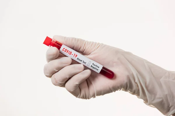 Beyaz Üniformalı Doktor Coronavirus Test Tüpü Taşıyan Bir Maske Takıyor — Stok fotoğraf