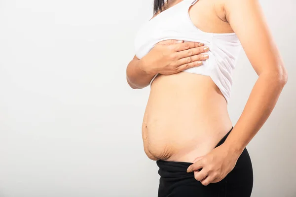 Primo Piano Della Donna Madre Asiatica Mostrando Smagliatura Allentato Basso — Foto Stock