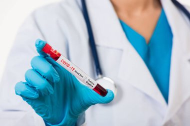 Beyaz üniformalı doktor Coronavirus test tüpü taşıyan bir maske takıyor. Klinik bir laboratuvarda, beyaz, ilaç COVID-19 salgın konseptini analiz etmek için kan örneği alınıyor.