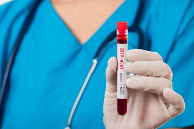 Mavi üniformalı hemşire laboratuarda beyaz arka planda izole edilmiş Coronavirus test kanını, COVID-19 ilaç salgın konseptini incelemek için bir maske takıyor.