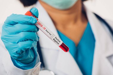 Beyaz üniformalı doktor Coronavirus test tüpü taşıyan bir maske takıyor. Klinik bir laboratuvarda, beyaz, ilaç COVID-19 salgın konseptini analiz etmek için kan örneği alınıyor.