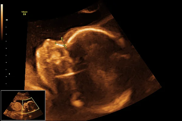 Ultra-som de raios-x bebê — Fotografia de Stock