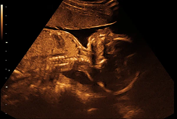Ultra-som de raios-x bebê — Fotografia de Stock