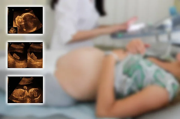 blurred background belly abdomen on ultrasound examination