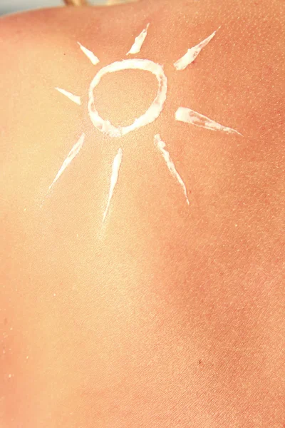 Сонцезахисний крем на спині — стокове фото