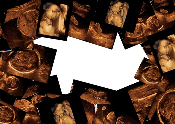 Baby on ultrasound image — Stock Photo, Image