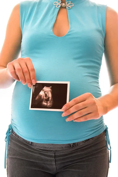 Bebé en ultrasonido en el abdomen — Foto de Stock