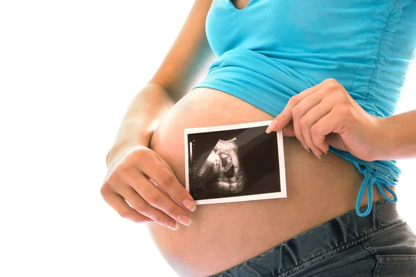 Bebê no ultra-som no abdômen — Fotografia de Stock