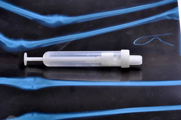 Serum syringe — Stock Photo, Image