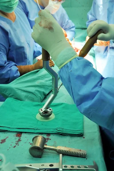 Hastanede kalça protezi — Stok fotoğraf
