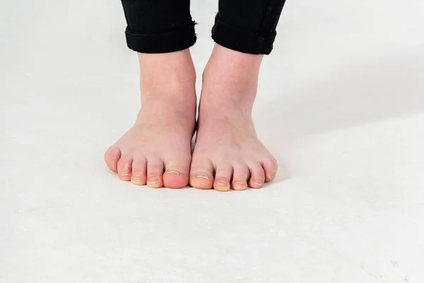 Close Naked Female Feet Natural Unpainted Toenails White Background — Stock Photo, Image