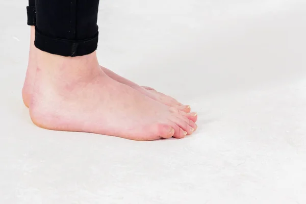 Çıplak ayaklı, doğal ve boyanmamış ayak tırnakları beyaz arka planda. Ayakların yan görünümü.