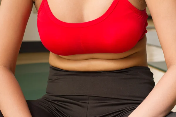 Fat belly of woman with excessive obesity — Stock Photo, Image