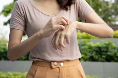 Elini kaşıyan Asyalı kadın; kuru cilt, alerjik cilt iltihabı, vücut bakımı, mantar iltihabı, dermatoloji hastalığı, egzama, isilik, cilt bakımı; genç yetişkin Asyalı kadın modeli