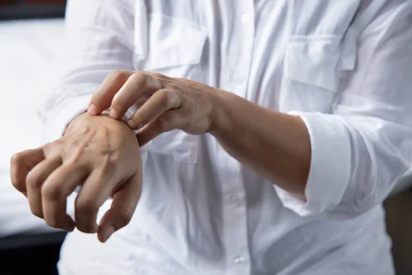 Wanita Gatal Menggaruk Kulit Tangannya Karena Kudis Eksim Cacing Gelang — Stok Foto