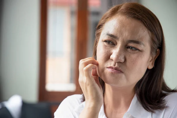 itching woman scratching her facial skin due to scabies, eczema, ringworm, allergic skin, atopic dermatitis symptoms