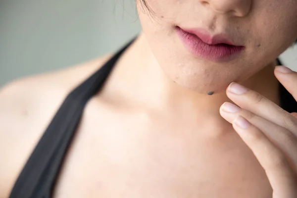 Lelijke Rimpel Gezicht Gezichtshuid Met Moedervlek Ruwe Grote Porie Vrouw — Stockfoto