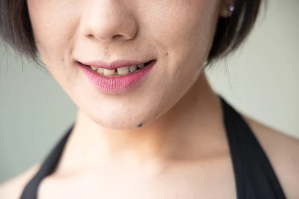 Mujer Con Dientes Huecos Diastema Cuidado Bucal Concepto Cuidado Dental —  Fotos de Stock