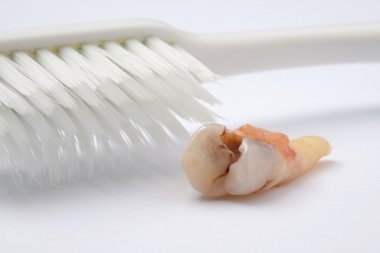 Beyaz arka plan üzerinde diş çürüğü