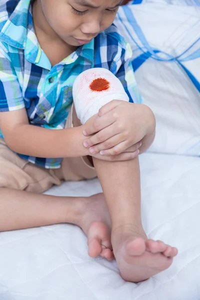 Kind verletzt. Wunde am Knie des Kindes mit Verband. — Stockfoto