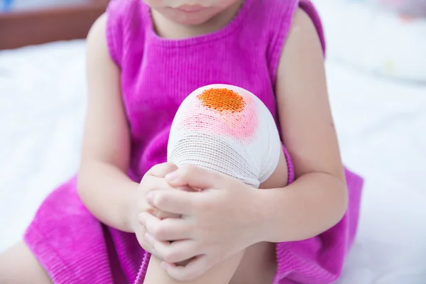 Child injured. Wound on the child's knee with bandage. — Stock Photo, Image