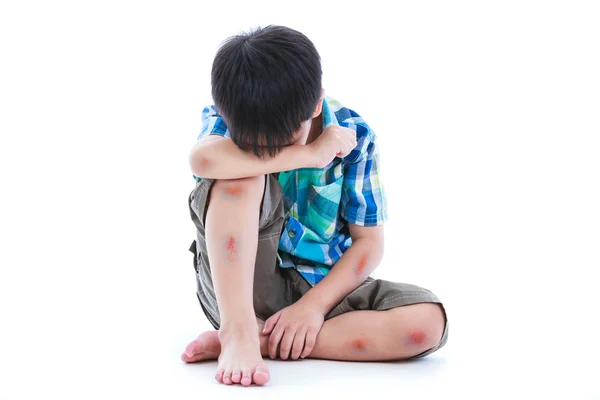 Um rapaz a tapar a cara. De acordo com o corpo com contusão de feridas. Isolar no fundo branco . — Fotografia de Stock