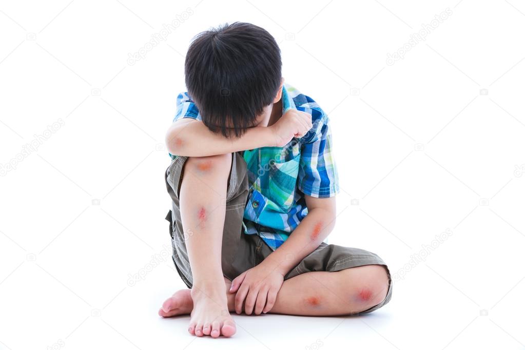 Young boy covering his face. According to the body with wounds contusion. Isolate on white background.