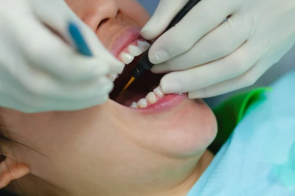 Aantrekkelijke Vrouw Ondergaat Tandheelkundige Behandeling Specialist Het Dragen Van Rubberen — Stockfoto