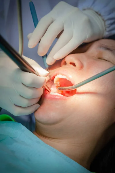 魅力的な女性は歯科治療を受けており ゴム手袋を身に着けている専門家は歯の患者を点検し 硬化させています 口腔衛生の概念 — ストック写真