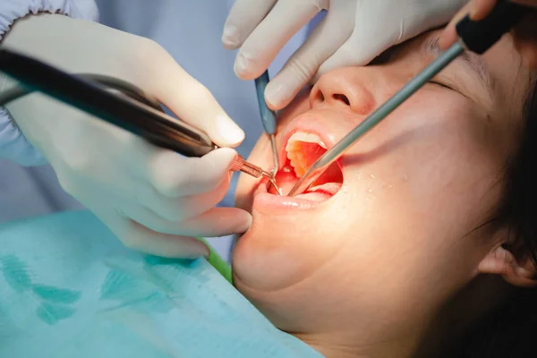 Attractive Woman Undergoing Dental Treatment Specialist Wearing Rubber Gloves Doing — Stock Photo, Image