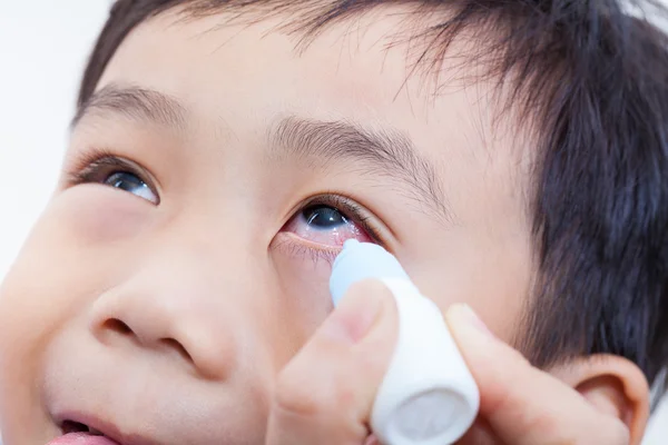 Close-up van bovenliggende gieten oog druppels in oog haar zoon — Stockfoto