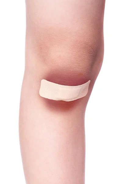 Child knees with a plaster (for wounds) and bruise — Stock Photo, Image