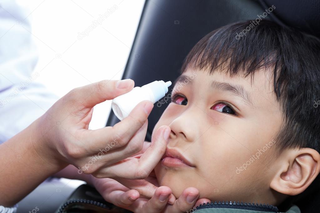 Closeup of doctor pouring eye drops in eye patient