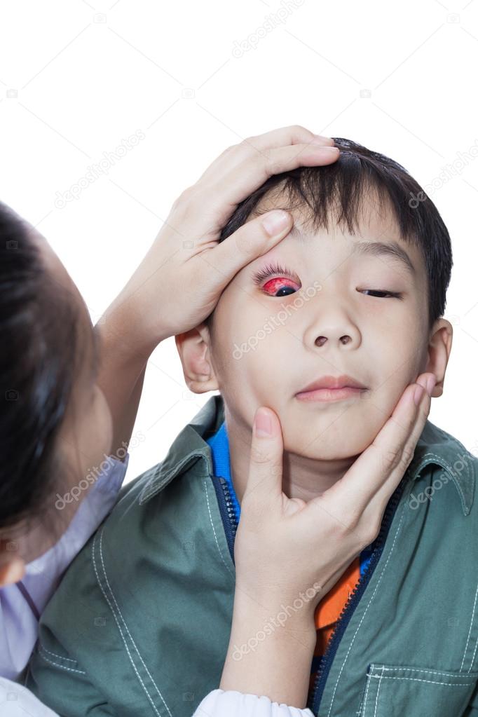 Pinkeye (conjunctivitis) infection on a boy, doctor check up eye