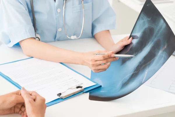 Médico mostrando radiografía de pulmones —  Fotos de Stock