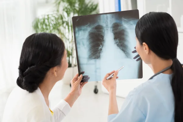 Médico examinando la radiografía de pecho — Foto de Stock