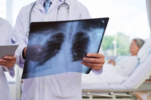 Radiografia de tórax nas mãos do médico — Fotografia de Stock