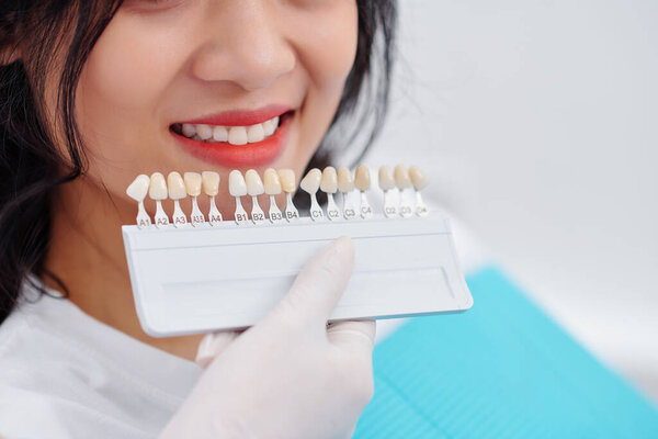 Close-up image of dentist using palette when choosing teeth color of female patient before whitening procedure