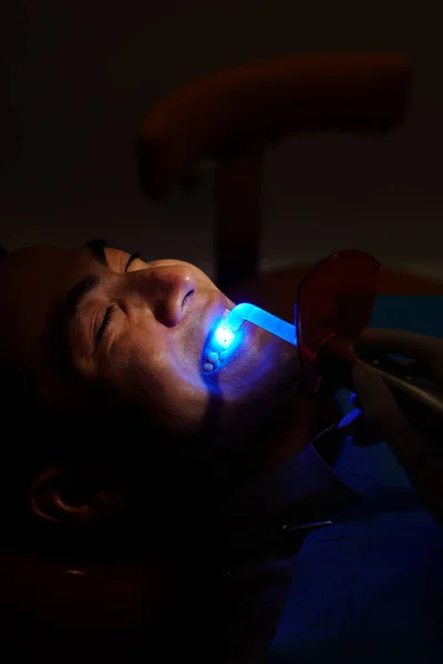 Dentista Aplicando Relleno Compuesto Base Resina Diente Del Joven Curándolo — Foto de Stock