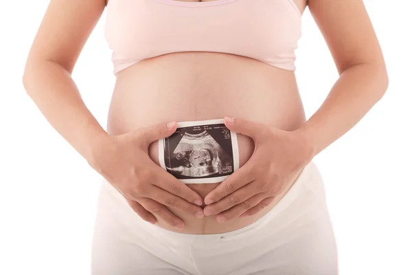 Pregnant woman holding ultrasound scan — Stock Photo, Image