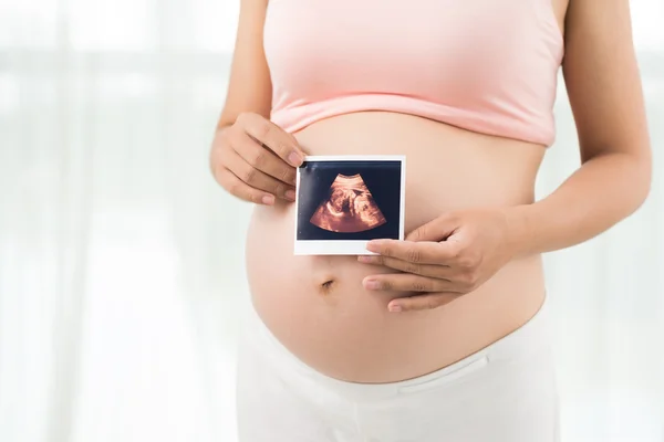 Mulher grávida mostrando ultra-som — Fotografia de Stock