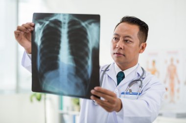 Doktor muayene akciğer röntgeni