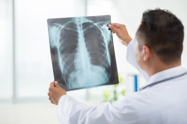 Doctor examining chest radiography — Stock Photo, Image