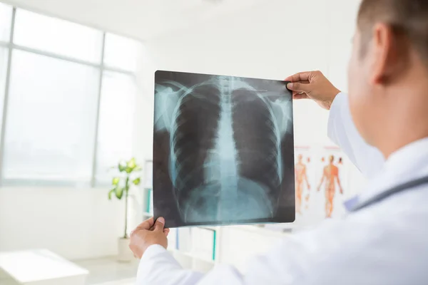 Radiologista olhando para radiografia de pulmões — Fotografia de Stock