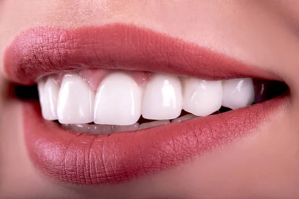 Dentes Saudáveis Perfeitos Belo Sorriso Largo Branqueamento Coroas Cerâmicas Branqueamento — Fotografia de Stock