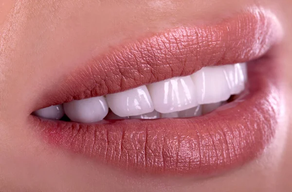 Perfect Healthy Teeth Beautiful Wide Smile Bleaching Ceramic Crowns Whitening — Stock Photo, Image